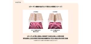 note コラーゲン線維の並びとシワ深さとの関係（イメージ）