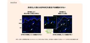 note 光老化した肌にはSPARRCを産生する細胞が少ない