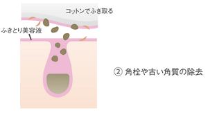 Wポアアプローチ処方　角栓や古い角質の除去イメージ