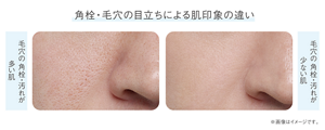 角栓・毛穴の目立ちによる肌印象の違い 毛穴の角栓・汚れが多い肌のイメージ　毛穴の角栓・汚れが少ない肌のイメージ