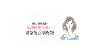 擦上粉底後仍無法遮飾泛紅……希望能立即改善！