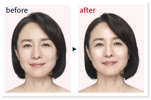 before after
