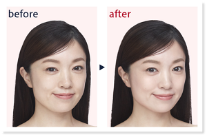 before after