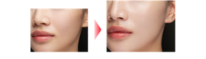Before After 仕上がりイメージ