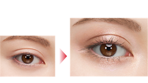 クリッと丸い目もと印象へ Before After 仕上がりイメージ（ PK-2）