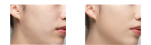 Before After
