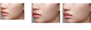 Before After 仕上がりイメージ（FORドライ）仕上がりイメージ（FORオイリー）