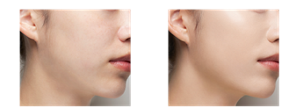 Before After