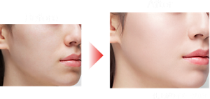 Before After 仕上がりイメージ（01）