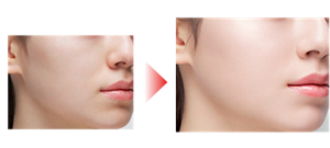 Before After 仕上がりイメージ（01）