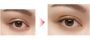 Before After 仕上がりイメージ（BR-1）