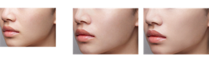 Before After 仕上がりイメージ （ＦＯＲドライ） 仕上がりイメージ （ＦＯＲオイリー）