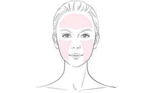 Illustration d'un visage où le front et les joues sont mis en évidence en rose pour indiquer la zone d'application.