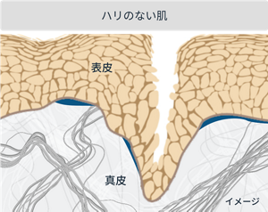 ハリのない肌 イメージ