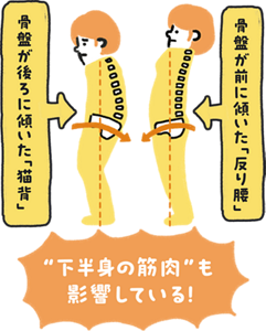 「猫背」「反り腰」下半身の筋肉も影響している！