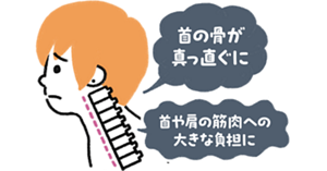 首の骨が真っ直ぐになることで、首や肩の筋肉への大きな負担に
