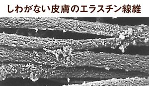 写真：しわがない皮膚のエラスチン線維の電子顕微鏡写真