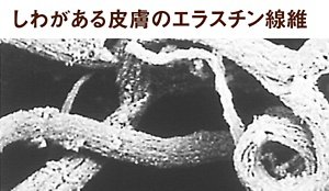 写真：しわがある皮膚のエラスチン線維の電子顕微鏡写真