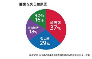 グラフ：歯を失う主原因　歯周病37％、むし歯29％、歯の破折18％、その他16％　平成30年　永久歯の抜歯原因調査報告書（8020推進財団）より作図