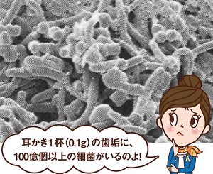 写真：電子顕微鏡で5000倍に拡大した歯垢 ビビコさんからのコメント「耳かき１杯(0.1グラム)の歯垢に100億個以上の細菌がいるのよ！」