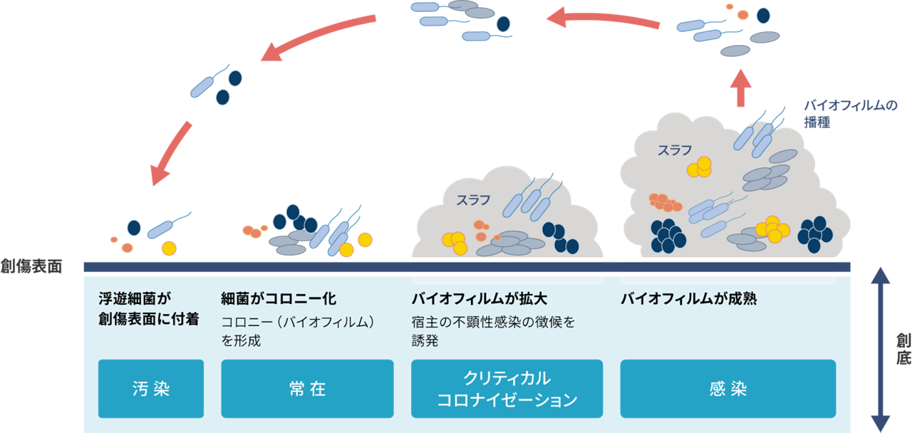 バイオフィルムの形成と成熟をあらわしたイラスト。浮遊細菌が創傷表面に付着し、細菌がコロニー、つまりバイオフィルムを形成する。バイオフィルムが拡大し、宿主の不顕性感染の調光を誘発し、最終的にバイオフィルムが成熟する。