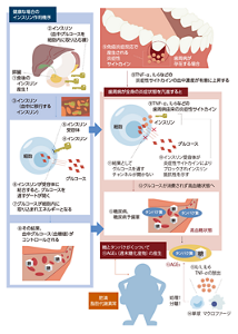 歯周病と糖尿病関連のメカニズムを表す図