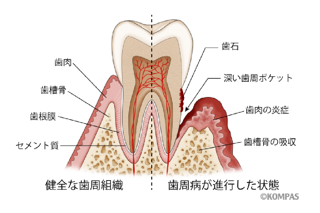 ファッション 歯周病 医療人として知るべきこと｜花王ハイジーンソルーション 語学・辞書・学習参考書