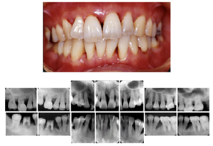 1999年初診時の写真