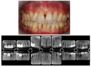 治療後21年の写真