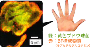 黄色ブドウ球菌、BF構成物質（N-アセチルグルコサミン）の写真。