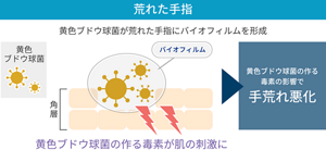 荒れた手指の状態を表すイラスト。黄色ブドウ球菌がバイオフィルムを形成し、黄色ブドウ球菌の作る毒素が肌の刺激になり、その毒素の影響で手荒れが悪化している。