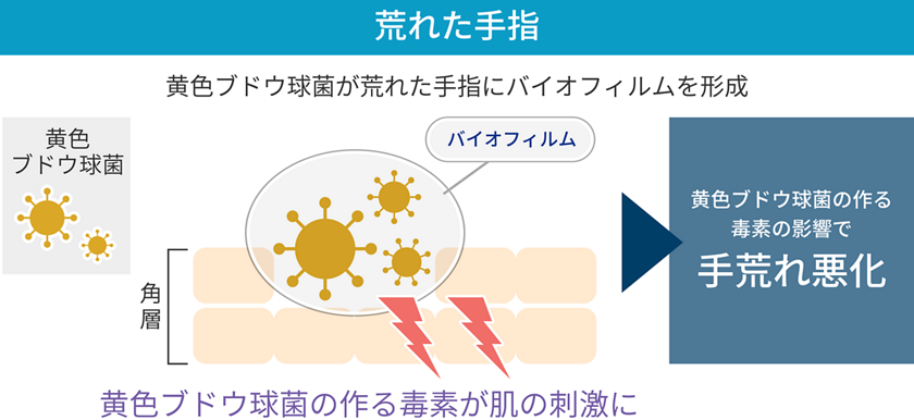 手荒れ悪化原因の1つ バイオフィルムとは｜花王プロフェッショナル ICNet