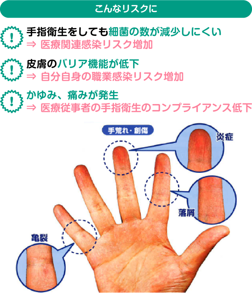 ソフティ ハンドサニタイザーシリーズを使用した手洗い 消毒 ハンドケア 花王プロフェッショナル 業務改善ナビ 介護の現場にソリューション ソフティ ハンドサニタイザーシリーズを使用した手洗い 消毒 ハンドケア 花王プロフェッショナル 業務改善ナビ 介護の現場にソリューション