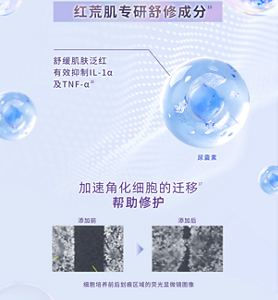 红荒肌专研舒修成分 舒缓肌肤泛红 有效抑制IL-1α 及TNF-α