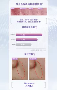 专业合作机构敏感肌实测 使用前 | 使用15分钟 | 使用7天 | 使用28天 使用15分钟 泛红改善 持续使用7天、28天后显著改善 角质层含水量↑ 使用前：54.90 使用7天：65.73 使用28天：73.06 角质层含水量均值（单位：C.U.） 皱纹改善↓ 使用前 | 使用28天 28天 皱纹减少 -9.94%
