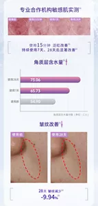 专业合作机构敏感肌实测 使用前 | 使用15分钟 | 使用7天 | 使用28天 使用15分钟 泛红改善 持续使用7天、28天后显著改善 角质层含水量↑ 使用前：54.90 使用7天：65.73 使用28天：73.06 角质层含水量均值（单位：C.U.） 皱纹改善↓ 使用前 | 使用28天 28天 皱纹减少 -9.94%