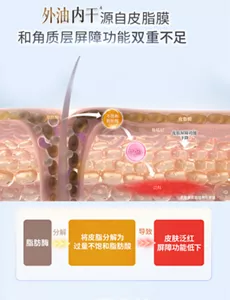 外油内干 源自皮脂膜 和角质层屏障功能双重不足