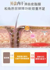 外油内干 源自皮脂膜 和角质层屏障功能双重不足