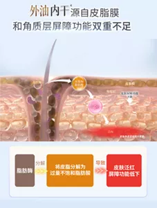 外油内干 源自皮脂膜 和角质层屏障功能双重不足