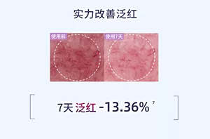 实力改善泛红 7天 泛红 -13.36%