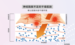 神经酰胺不足的干燥肌肤 难以抵御外部干燥环境