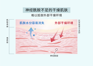 神经酰胺不足的干燥肌肤 难以抵御外部干燥环境 