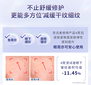 不止舒缓修护 更能多方位9减缓干纹细纹 受试者使用产品4周5后 皮肤紧致度皮肤弹性 得到提升5 眼周亦可安心使用 4周5受试者眼下 皱纹面积均值 -11.45% 