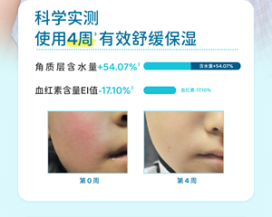 科学实测 使用4周3  有效舒缓保湿角质层含水量+54.07%3 血红素含量EI值-17.10%3