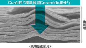 tw_img_ceramide_care_06