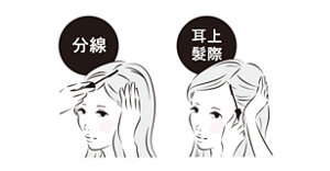 髮際線塗抹示意圖