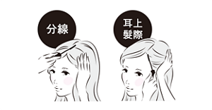 髮際線塗抹示意圖