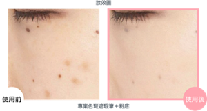 妝效圖 專業色斑遮瑕筆＋粉底