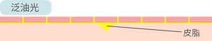 泛油光　皮脂