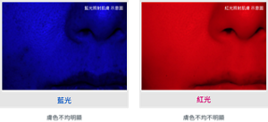 藍光照射肌膚 示意圖 藍光 膚色不均明顯 紅光照射肌膚 示意圖 紅光 膚色不均不明顯